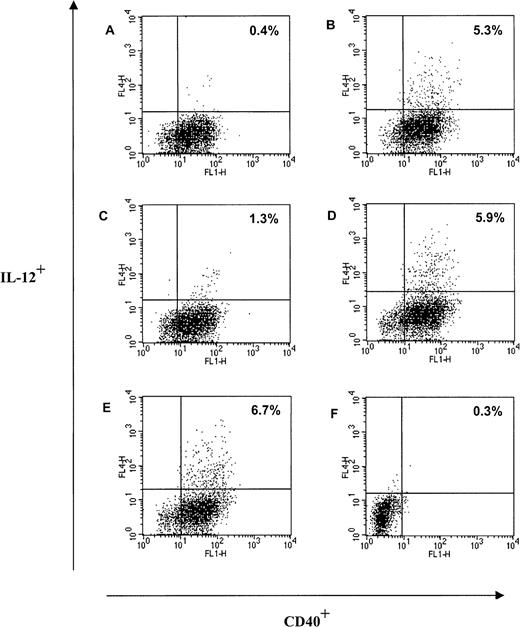 Fig. 7. Trx80 induces production of IL-12 from CD40+monocytes in PBMC. / Human PBMC were cultured in AIM V medium in ultralow attachment plates for 48 hours. Twenty-two hours before terminating the cultures, Brefaldin A was added to each culture. After harvesting, the large cell population in PBMC was analyzed for intracellular expression of IL-12 and expression of CD40. The culture conditions were unstimulated cells (A), Trx80 1 μM (B), IL-2 at 20 U/mL (C), Trx80 1 μM and IL-2 at 20 U/mL (D), LPS 100 ng/mL (E), and unstimulated cells with isotype-matched antibodies for IL-12 and CD40 (F). One representative experiment of 4 is shown. The proportion of cells positive for both CD40 and IL-12 is indicated in upper right corner.