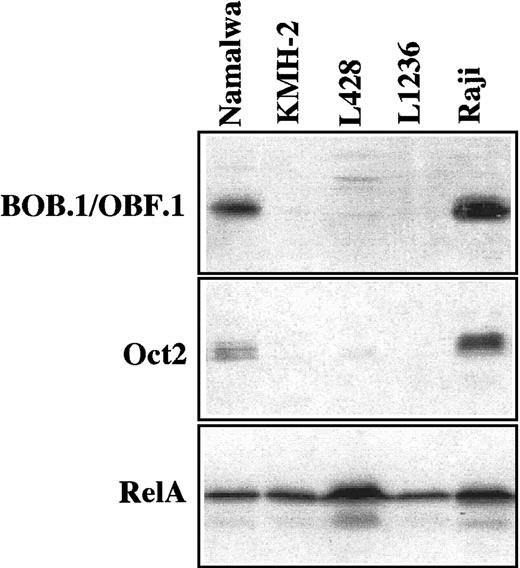 Fig. 3. Western blot analysis for BOB.1/OBF.1 and Oct2. / Expression of BOB.1/OBF.1 and Oct2 was analyzed with 50 μg whole cell protein extracts; RelA was investigated in parallel for control. There was no expression of Oct2 and BOB.1/OBF.1 in the HD-derived cell lines KMH-2, L428, and L1236, whereas Raji and Namalwa (B-cell control cell lines) were clearly positive. The presence of RelA demonstrates equal amounts of intact protein in all cell lines.