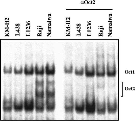 Fig. 4. Electromobility shift and supershift analysis (Oct2). / The presence of Oct2 with DNA binding activity was investigated in the HD-derived cell lines KM-H2, L428, and L1236 and B-cell control cell lines Raji and Nalmalwa. No Oct2 DNA binding activity was observed in the HD-derived cell lines, whereas both control cell lines showed high DNA binding activity (left panel). Super shift analysis with Oct2-specifc antibodies (right panel) demonstrated the specificity of our technique. Note: Oct1 was present in all cell lines investigated.