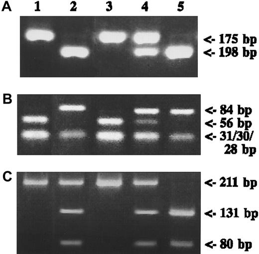 Fig. 2. Polymorphisms of. / MTHFR and MS genes. (A) Genomic DNA from each control subject was amplified with MTHFR677 primers digested with HinfI and was run on a 4% agarose gel. (B) Results for MTHFR1298 with MboII digestion. (C) Results for MS2756 with HaeIII digestion. DNA fragments stained with ethidium bromide are shown. Lane 1, positive control for wild type; lane 2, positive control for mutant type, except for heterozygote in panel C; lane 3, wild type; lane 4, heterozygote; lane 5, mutant.