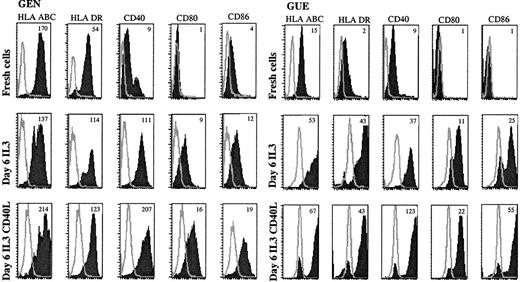 Fig. 4. Leukemic cells up-regulate costimulatory molecules upon IL-3 and CD40L activation. / Expression of APC-related molecules on fresh and cultured leukemic cells were shown in patient GEN and GUE CD40, CD80, and CD86 that were either not expressed or were present at a low level on fresh cells (upper panels) were up-regulated after a 6-day culture with IL-3 (middle panels). HLA molecules that were already present on fresh cells were also up-regulated. Addition of CD40L-transfected L cells during the last 48 hours of culture further increased the expression of these molecules (lower panels). Open curves show isotype control; shaded curves show specific staining. Results are representative of 5 experiments of culture with IL-3. Mean fluorescence intensity ratios between specific mAb and isotypic control are indicated in the plot.