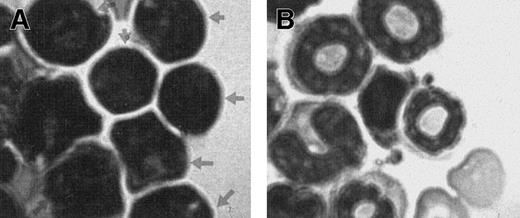 Fig. 2. Presence of human leukemia cells on mouse bone marrow smear. / (A) Bone marrow smear from a mouse 6 weeks after injection with cells from a patient with T-ALL showing the characteristic morphology of leukemia blasts (arrowheads). (B) Bone marrow smear from a control NOD/SCID mouse showing the characteristic leukocytes. Bone marrow smears were stained with modified Wright stain.