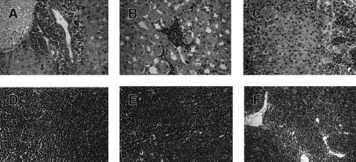 Fig. 4. Histologic analysis of leukemic infiltrates in engrafted NOD/SCID mice. / Tissue sections (A-E) were obtained from a mouse preconditioned with 25 × 106 cord blood MNCs 7 days before the injection of 36 × 106 primary T-ALL cells. The mouse was killed 40 days after the T-ALL injection. Tissues were fixed in aqueous-buffered zinc formalin and embedded in paraffin; 4-μm sections were prepared and stained with hematoxylin and eosin. (A) Liver, (B) kidney, (C) adrenal gland, (D) lymph node, and (E) thymus from the engrafted mouse. For comparison, a tissue section (F) was obtained from the normal thymus of an unmanipulated, age-matched NOD/SCID mouse. Human T-ALL engraftment levels in bone marrow and spleen for this mouse were found by flow cytometry to be 85% and 78%, respectively (not shown).