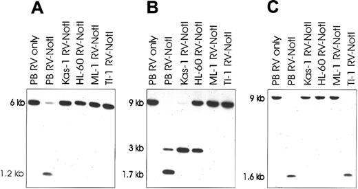 Fig. 4. Southern blots showing methylation of RLGS clones in AML cell lines. / Lane 1: Control normal donor peripheral blood (PB) is digested withEcoRV only (RV only) to show size of unmethylated band. Lanes 2-6: PB and AML cell line DNA is double-digested withEcoRV and methylation-sensitive NotI (RV-NotI). The presence of an uncut band in these lanes is indicative of methylation at the NotI site. Blots are probed with the RLGS clones 2C40 (panel A), 5C08 (panel B), and 3B36 (panel C). The 1.7-kilobase (kb) band in (panel B) is due to partial methylation of an internal NotI site within the larger 3-kbEcoRV-NotI fragment. Kas-1 indicates Kasumi-1.