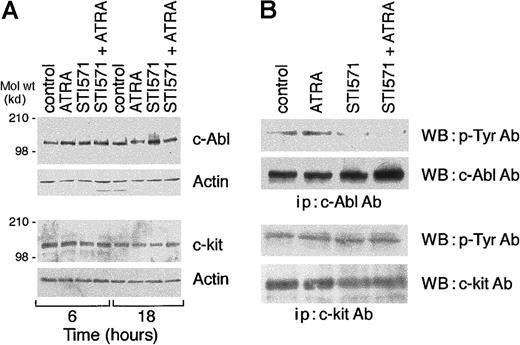 Fig. 8. Effects of STI571 and ATRA on the levels tyrosine phosphorylation of c-Abl and c-kit. / NB4 cells seeded at an initial concentration of 2 × 105/mL were treated with STI571 (5 × 10−6 M), ATRA (10−7 M), or the combination of the 2 compounds for the indicated amount of time (A) or for 16 hours (B). In (A), cell extracts (50 μg protein/lane) were subjected to Western blot analysis with c-Abl, c-kit, or β-actin antibodies. In (B), cell extracts were immunoprecipitated (ip) with c-Abl or c-kit antibodies. The immunoprecipitates were run on a 6% polyacrylamide gel and subjected to Western blot analysis (WB) with antiphosphotyrosine antibodies (p-Tyr Ab), c-Abl, or c-kit antibodies. The results are representative of 2 independent experiments.