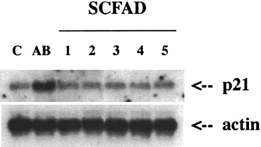Fig. 6. Northern blot analysis of p21 expression in 32D cells with and without treatment with SCFADs. / The mRNA was prepared from cells cultured for 1 day. p21 expression was induced 3-fold with arginine butyrate (AB) compared to control (C) 0.5 U/mL IL-3 alone. In contrast, the short-chain fatty acid derivatives, 2,2 dimethylbutyric acid (1); α-methylhydrocinnamic acid (2); DL-α amino-n-butyric acid (3); phenoxyacetic acid (4); and 2,2 dimethylmethoxyacetic acid (5) were not significantly different from the control cells treated with 0.5 U/mL IL-3 alone.