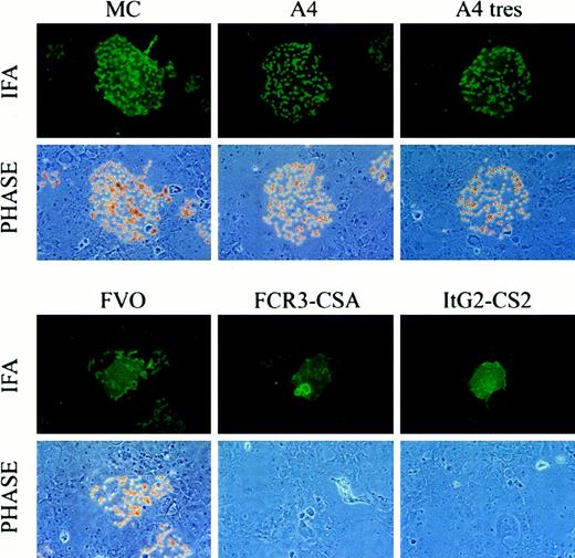 Fig. 1. CD36 binding of CIDR-1 recombinant proteins. / CIDR-1 recombinant proteins from CD36-adherent parasites, but not CSA-adherent parasites, bind CD36. Soluble CD36 was immobilized to beads coated with M1 anti-FLAG mAb. Coated beads were incubated with COS-7 cells grown on coverslips and transfected with different constructs. After washing and fixation, the colocalization of beads and transfected cells was quantified by means of a specific monoclonal antibody against an epitope tag incorporated carboxy terminal to the cell-surface–expressed protein. The degree of bead association was examined under immunofluorescence and phase microscopy. CD36-coated beads specifically bound COS-7 cells expressing CIDR-1 from CD36-adherent strains (MC, A4, A4tres, and FVO) but not CIDR-1 from CSA-adherent strains (FCR3-CSA and ItG2-CS2).
