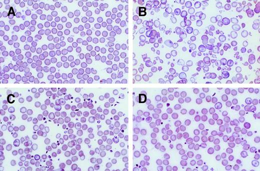 Fig. 2. PB smears of β-thalassemic/normal hematopoietic chimeras to demonstrate amplification of the genetically normal red cells. / (A) Wright-Giemsa–stained PB smear from an animal transplanted with genetically normal BM. (B) Smear from an animal transplanted with β-thalassemic BM. (C) Smear from a chimeric animal with 12% normal HSCs and 56% normal Hb in the PB. (D) Smear from a chimeric animal with 20% normal HSC engraftment and 81% normal Hb in the PB. Photomicrographs are at 250 × magnification.