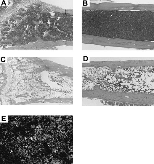 Fig. 3. Histologic findings in tibia and femur of a MRL/lpr mouse 14 days after treatment with 5.5 Gy × 2 + IBM or 5.5 Gy × 2 + IV. / The tibia (directly injected with BMCs, A) and femur (not injected, B) of the MRL/lpr mouse treated with 5.5 Gy × 2 + IBM show hyperplastic bone marrow 14 days after the treatment. In contrast, the tibia (C) and femur (D) of the mouse treated with 5.5 Gy × 2 + IV show hypoplastic bone marrow 14 days after the treatment. (E) Immunohistochemical analysis of bone marrow treated with 5.5 Gy × 2 + IBM. The frozen specimen of the bone marrow from the tibia was stained with anti-PA6 mAb followed by PE-antirat IgM and further stained with FITC-anti-H-2Db mAb. The stained samples were examined on a confocal laser scanning microscope. Note that there is a scattering of cells stained both with anti-PA6 mAb and anti-H-2Db mAb (yellow-colored). Donor-derived BMCs are stained green.