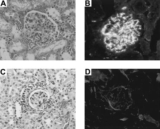 Fig. 7. Pathologic findings in glomeruli of MRL/lpr mouse kidneys. / A nontreated MRL/lpr mouse (20 weeks old) shows the proliferation of mesangial cells in the glomerulus (A) and marked IgG deposits (B). A MRL/lpr mouse (60 weeks old) treated with 5.5 Gy × 2 + IBM shows normal appearance (C) without C3 deposits (D) 40 weeks after the treatment.