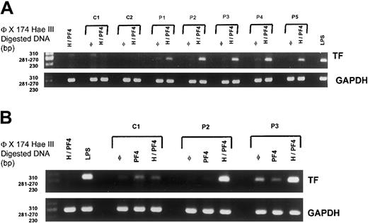 Fig. 2. Monocyte TF in RNA synthesis. / (A) Tissue factor mRNA synthesis in immunopurified monocytes after the incubation of normal (C1-C2) or HIT IgG (P1-P5) in whole blood at 500 μg/mL in the absence (φ) or the presence of PF4 (10 μg/mL) with heparin (0.25 IU/mL) (H/PF4). Whole blood was also incubated in the presence of H-PF4 complexes without IgG or in the presence of LPS as a positive stimulation control (LPS). (B) Effects of IgG purified from one sample of normal plasma (C1) and from 2 selected patients (P2 and P3) tested alone (φ) or in the presence of PF4 without (PF4) or with (H/PF4) heparin.
