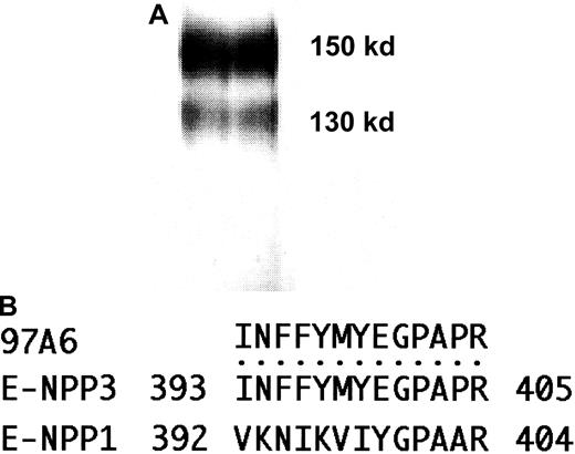 Fig. 1. MoAb 97A6 detects 130- and 150-kd proteins that correspond to E-NPP3. / (A) Lysates of KU-812 cells were affinity purified on a 97A6-Sepharose column and separated on 7.5% SDS-PAGE. The silver-stained proteins had a molecular mass of 130 kd and 150 kd, respectively. (B) The sequences of E-NPP1 (PC-1) and E-NPP3 (PDNP3) are aligned with tryptic HPLC-purified 97A6 peptides derived from the cut bands shown in panel A. The sequence of the digested peptides (identical peptides from both bands) shows a complete match with amino acids 393 to 405 of E-NPP3. Although the primary structures of E-NPP family proteins share a significant similarity, the sequence of this region differs considerably between E-NPP1 and E-NPP3.