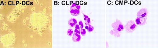 Fig. 1. Morphology of in vitro–generated DCs from CLPs and CMPs. / (A) Typical clusters of DCs developing from 1 × 103 CLPs cultured with IL-1β, IL-3, IL-4, IL-7, SLF, TNF-α, and Flt3-L. Clusters were photographed directly in the Terasaki tray on an inverted microscope (objective × 40) on day 4 of culture. (B, C) Cells developing from 100 CLPs in the above cocktail on day 4 or from 5000 CMPs in IL-3, IL-4, SLF, TNF-α, Flt-3L, and GM-CSF on day 6 were dissociated with EDTA, spun onto slides, and stained with Giemsa (objective × 60 oil). Almost all CLP-derived cells (B) and a substantial fraction of CMP-derived cells (C) displayed typical DC morphologies varying in size and nuclear shape.