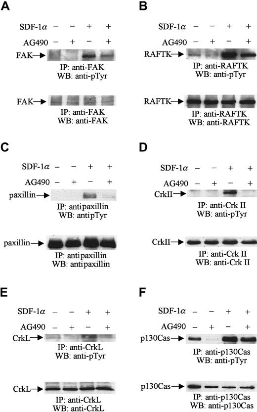 Fig. 5. JAK2 is required for the SDF-1α–induced phosphorylation of the focal adhesion components FAK, RAFTK, paxillin, CrkII, CrkL, and p130Cas. / CTS cells, pretreated with AG490 (100 μM) (+) or DMSO (−) for 2 hours, were stimulated with 20 nM SDF-1α for 1 minute and lysed. Total cell lysates were immunoprecipitated with anti-FAK (A), anti-RAFTK (B), antipaxillin (C), anti-CrkII (D), anti-CrkL (E), and anti-p130Cas (F) antibodies, and the immunoprecipitates were analyzed by Western blotting with PY99 antibody (pTyr) (upper panels). After stripping, the membranes were reprobed to assure equal protein loading (A-F, lower panels).