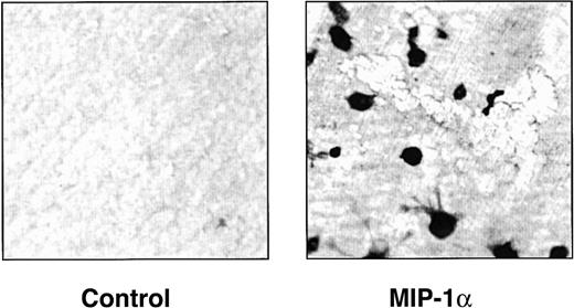 Fig. 4. hMIP-1α induces osteoclasts that resorb dentin. / Human CFU-GM–derived cells were cultured in the presence of dentin slices in the presence or absence of MIP-1α (200 pg/mL). At the end of the cultures, the dentin slices were stained for tartrate-resistant acid phosphatase activity and then photographed. Similar results were seen in 2 independent experiments (original magnification × 100).