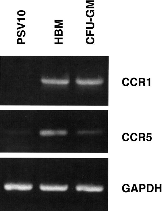 Fig. 5. Osteoclast precursors express MIP-1α receptors. / Isolated human bone marrow and CFU-GM–derived cells were prepared and subjected to RT-PCR analysis for CCR1 and CCR5 expression. Human bone marrow (HBM) and CFU-GM–derived cells both expressed CCR1 and CCR5. Human marrow stromal cells (PSV10) only expressed the CCR5 receptor in low concentrations. Controls for these experiments were expression of GAPDH messenger RNA.