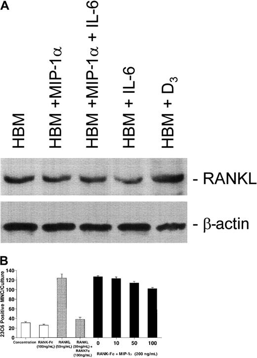 Fig. 9. MIP-1α and IL-6 do not increase RANKL expression in human bone marrow and RANK-Fc does not inhibit MIP-1α–stimulated osteoclast formation. / (A) Cells were incubated for 48 hours with media, 1,25-(OH)2D3 (10−8 M), IL-6 (100 pg/mL), MIP-1α (200 pg/mL), or a combination of MIP-1α and IL-6. The cells were then collected and the lysate subjected to Western blot analysis. 1,25-(OH)2D3 increased RANKL expression in human bone marrow cultures. IL-6, MIP-1α, or IL-6 plus MIP-1α did not significantly increase RANKL expression in human bone marrow. Expression of β-actin is shown as a control. There was no effect on β-actin expression. (B) CFU-GM–derived cells were prepared and then treated with RANKL (50 ng/mL) or MIP-1α (200 pg/mL) in the presence of varying concentrations of recombinant RANK-Fc (0-100 ng/mL). RANK-Fc significantly decreased RANKL-stimulated osteoclast formation in human marrow cultures. In contrast, RANK-Fc modestly affected or did not affect osteoclast-like cell formation stimulated by MIP-1α. High concentrations of RANK-Fc (100 ng/mL) decreased basal osteoclast formation in these cultures. Results represent the mean ± SEM for quadruplicate determinations for a typical experiment. Similar results were seen in 2 independent experiments.