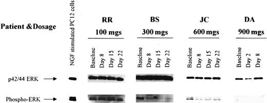 Fig. 3. Detection of ERK and phospho-ERK in leukemic marrow samples from 4 selected patients obtained before therapy (baseline) and at weekly intervals during R115777 administration. / ERK expression was detected before and after treatment in marrow samples from all 4 patients, and phospho-ERK as detected in 3 samples at baseline. Of note, phospho-ERK disappeared following R115777 treatment in samples from 2 of the 3 patients whose marrow populations exhibited baseline phospho-ERK expression.