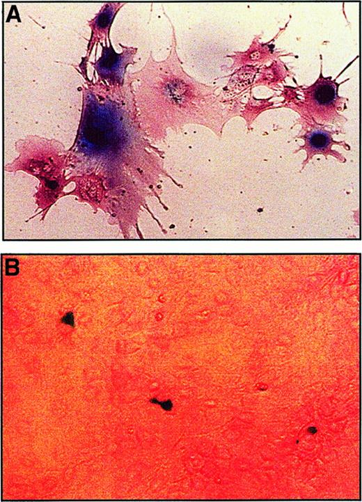 Fig. 1. Transduction of thymic epithelial cells with a MuLV-based vector. / (A) In vitro (×40). Pure cultures of thymic epithelium were established from a normal control sheep fetus at 76 days of gestation as described in “Materials and methods.” The thymic epithelial cells were then transduced in vitro with the MuLV-based G1nBgSvNa8.1 supernatant employed in our in utero studies, selected for 1 week in G418, and subjected to x-gal staining. All of the cells present are blue, demonstrating their successful transduction with the MuLV vector. (B) In vivo (×10). Representative in utero–transduced sheep were killed at 21 days postinjection (76 days of gestation) and pure cultures of thymic epithelial cells were grown as described in “Materials and methods.” The thymic epithelial cells were then subjected to x-gal staining. Numerous blue cells are present, demonstrating the successful in vivo transduction of thymic epithelium in the in utero–transduced sheep. We never observed any blue cells in x-gal–stained epithelial cell cultures from control (untransduced) sheep (data not shown).