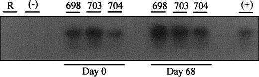 Fig. 4. Detection of the. / lacZ gene in the PBMCs of in utero–transduced sheep prior to and at day 68 postimmunization with β-gal. Reagent (R) consisted of all the constituents of the PCR reaction mixture except template DNA. Negative control (−) was DNA isolated from PBMCs of a normal control sheep. Positive control (+) consisted of DNA isolated from a human fibroblast cell line that had been transduced with the same vector and subsequently diluted in normal sheep DNA.