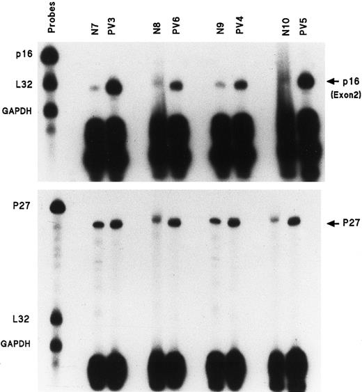 Fig. 2. Enhanced amount of mRNA transcripts for p16 exon 2 and p27 in the ECFCs of 4 patients with PV. / Experiments performed as in Figure 1, but with only p16, L32, and GAPDH gene probes or p27 and L32 and GAPDH.