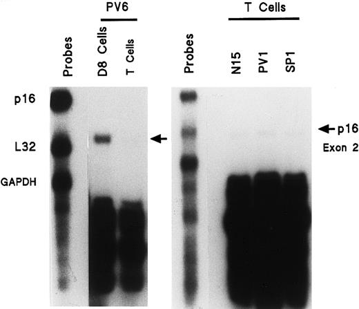Fig. 4. Enhanced expression of mRNA transcript for p16 (exon 2) is not present in activated PV T cells compared with PV ECFCs (left panel) and compared with activated T cells of a healthy or SP donor (right panel). / T cells from the BFU-E purification process were incubated for 24 hours with 3 μg/mL PHA. Cells were then washed and incubated for 5 days with 30 U/mL IL-2. RNA was then isolated and experiments were performed as in Figure 1, but with only p16 (exon 2), L32, and GAPDH gene probes. Activated PV T cells are compared with PV ECFCs (left panel) and with activated T cells of a healthy or SP donor (right panel).
