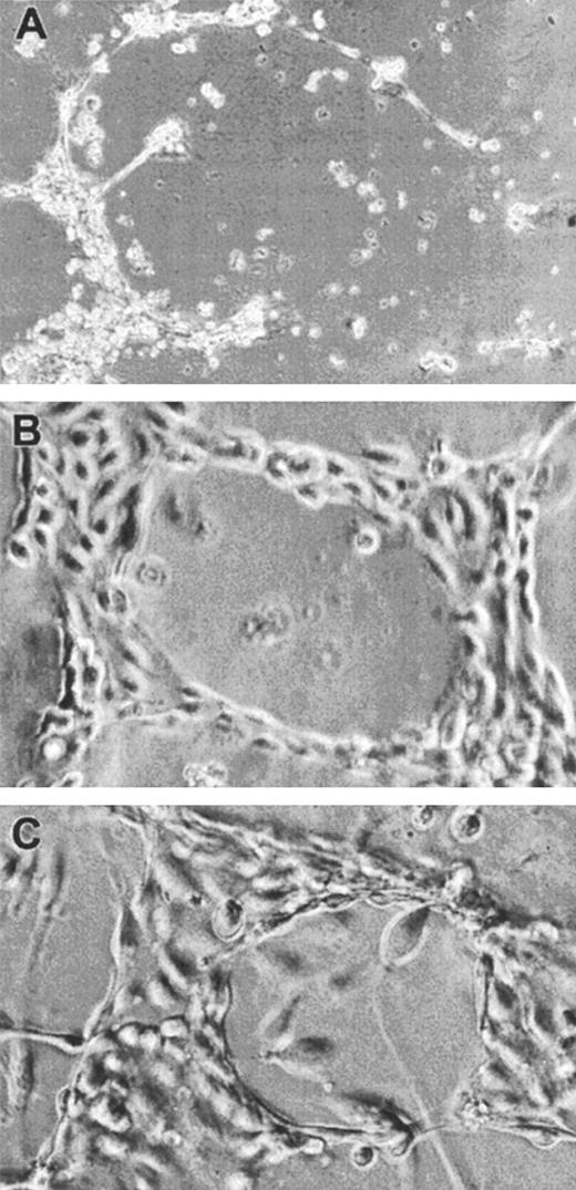 Fig. 4. Effect of α2M* on FGF-2–induced endothelial tubule formation on Matrigel. / FBHE cells were plated on Matrigel and incubated at 37°C for 96 hours in the absence of FGF-2 (A), 0.625 ng/mL FGF-2 (B), and 0.625 ng/mL FGF-2 incubated with 0.5 mg/mL α2M* (C). Photographs are representative fields from 4 experiments at 25 × (A) or 50 × (B,C) magnification.