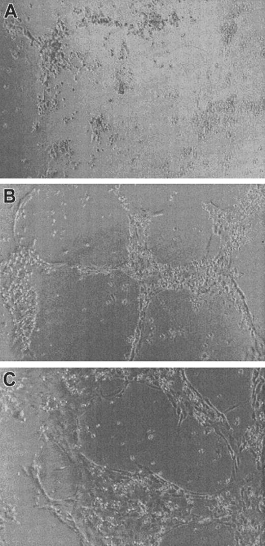 Fig. 5. Effect of α2M* on FGF-2–induced endothelial tubule formation on collagen gel. / HUVECs were plated on collagen type I gels and incubated at 37°C for 24 hours in the absence of FGF-2 (A), 100 ng/mL FGF-2 (B), and 100 ng/mL FGF-2 incubated with 0.5 mg/mL α2M* (C). Photographs are representative fields at 10 × magnification.