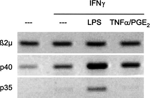 Fig. 2. The combination of TNFα and PGE2 induces IL-12p40 gene expression but fails to induce IL-12p35. / DCs (3 × 105 cells in 2 mL) were stimulated for 6 hours with one of the following stimuli: TNFα (50ng/mL) and PGE2 (10−6 M) or LPS (250 ng/mL) in the presence of IFNγ (1000 U/mL), as indicated, and lyzed for mRNA extraction. The expression of p35, p40, and β2m was analyzed with RT-PCR (see “Materials and methods”). The data shown are from a representative experiment of 3 performed.