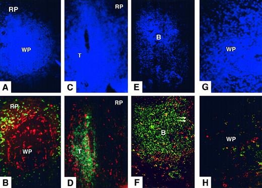 Fig. 2. Distribution of CD11c+ spleen DC in normal donors. / (A,B) Triple staining for nuclei (Hoechst, A) CD11c (Texas Red, B), and CD14 (FITC, B). Donor 147; original magnification, ×200. Strongly labeled CD11c+ DCs are scattered throughout the white pulp (WP) and surround its periphery, just inside red pulp (RP) CD14+ macrophages. (C,D) Triple staining for nuclei (Hoechst, C), CD11c (Texas Red, D), and CD3 (FITC, D). Donor 108; original magnification, ×200. Strongly labeled CD11c+ DCs are found mostly in the T-cell zone (T) and the marginal zone. (E,F) Triple staining for nuclei (Hoechst, E), CD11c (Texas Red, F), and CD19+CD20 (FITC, F). Donor 173; original magnification, ×200. CD11c+ CD19−CD20− cells are found around the edge and in the interior of the B-cell zone (B). (G,H) Triple staining for nuclei (Hoechst, G), CD86 (Texas Red, H), and CD83 (FITC, H) in a section of white pulp. Donor 147; original magnification, ×400. Rare CD86+ or CD83+ cells are found in the white pulp. Distribution and phenotype of spleen DCs observed in these donors were representative of those found in 5 organ donors.