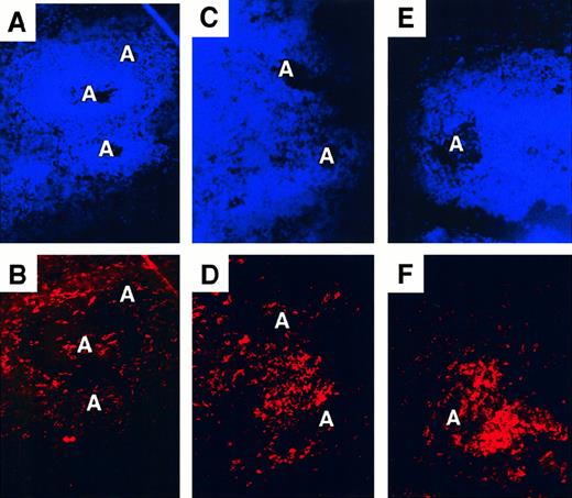 Fig. 4. Perturbed distribution of CD11c+ spleen DCs in some donors. / Double staining for nuclei (Hoechst, A,C,E) and CD11c (Texas Red, B,D,F). Original magnification, ×200. (A, B) Donor 147 showing a normal distribution of CD11c+ DCs around the edge of the white pulp and scattered CD11c+ DC around the arteriole (A). (C,D) Donor 106. (E,F) Donor 93. CD11c+ cells are concentrated in the white pulp in proximity to arterioles.