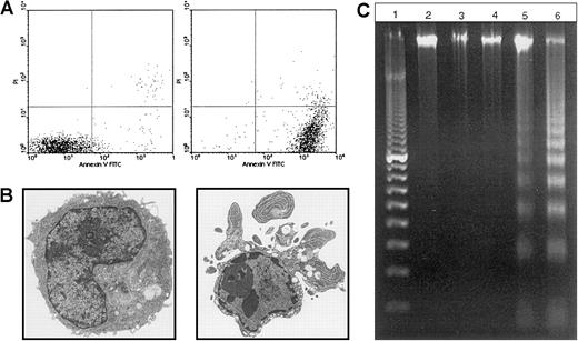 Fig. 3. 12B1-D1 cells exposed to AP20187 undergo apoptosis. / (A) The 12B1-D1 clone was cultured in the presence of 40 nM AP20187, and induction of apoptosis was assessed by Annexin V and PI staining at the indicated times. (B) Electron micrographs of 12B1-D1 cells exposed to AP20187 at 0, 6 hours (6000×). (C) DNA fragmentation analysis. Lane 1, 100-bp ladder; lane 2, DNA extracted from 12B1-D1; lane 3, 12B1-D1 + HS (A), cells were heat shocked at 42°C for 1 hour; lane 4, 12B1-D1 + HS (B), cells were heat shocked at 42°C for 1 hour and then incubated for 6 hours at 37°C; lane 5, 12B1-D1 + AP20187 for 6 hours; lane 6, 12B1-D1 + HS for 1 hour + AP20187 for 6 hours.