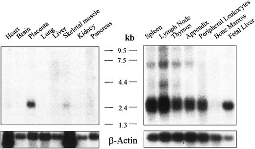 Fig. 3. mRNA analysis for human Ly-9. / Northern blot analysis showing the expression of human Ly-9 mRNA in lymphoid and nonlymphoid tissues. Autoradiography was scanned with a Bio-Profile densitometer (Vilber Lourmat, Marne la Vallee, France).