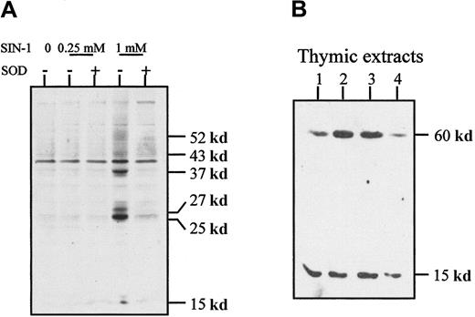 Fig. 7. Tyrosine nitration in thymocytes. / (A) Western blot analysis of thymocyte extracts with an antinitrotyrosine antibody showed that SIN-1 induced a high level of tyrosine nitration on several proteins, an effect partly reversed by exogenous SOD. These data are representative of 3 different experiments. (B) Western blot analysis of normal thymic extracts with an antinitrotyrosine antibody showed 2 major bands in all the samples studied. The data shown are representative of 3 different experiments and 10 distinct thymic samples.