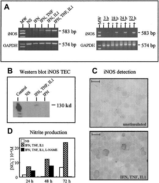 Fig. 10. TECs produce iNOS after activation. / (A) RT-PCR analysis of iNOS expression. TECs expressed iNOS only after stimulation by a cocktail of cytokines. Optimal expression was observed using IFN-γ, IL-1β, and TNF-α. In these optimal conditions, iNOS was barely detected after 3 hours and clearly observed after 18 hours. (B) Western blot analysis showed the presence of iNOS protein (130 kd) in TECs activated in optimal conditions but not in unstimulated cells. The positive control consisted of stimulated macrophages. (C) Immunoperoxidase analysis of iNOS expression in cultured TECs. TECs expressed significant levels of iNOS after 24 hours of optimal activation; unstimulated cells were unreactive. The scale bar represents 20 μm. (D) NO2 accumulation in TEC culture supernatants was measured by using the Griess reagent. The specificity of the reaction was checked by using L-NAME, an inhibitor of NO2 synthesis.