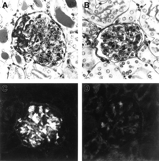Fig. 2. Representative histologic appearance of glomeruli in mice injected with L8D or 6-19J cells and glomerular IgG deposits in mice injected with purified L8D or 6-19J IgG3 mAb. / Mice injected with L8D cells (A) developed severe glomerular lesions characterized by the massive deposition of PAS-positive materials along the glomerular capillary walls, corresponding to the “wire-loop” lesions, with some proliferative and exudative changes, whereas no significant glomerular changes were seen in 6-19J–injected mice (B) (PAS; magnification, 200×). Note substantial glomerular deposits of IgG 24 hours after intraperitoneal injection of 10 mg L8D mAb (C), which markedly contrast with the lack of deposits in mice injected with the same dose of 6-19J mAb (D) (magnification, 200 ×).