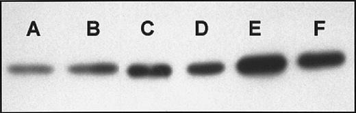 Fig. 2. Immunoblots of cytosolic cytochrome c. / Western blot analysis of cytochrome c was performed in the cytosolic fraction of RPMI 8226 cells treated in the absence (A) or presence of 180 μM imexon for 4 hours (B), 8 hours (C), 16 hours (D), 24 hours (E), and 48 hours (F).