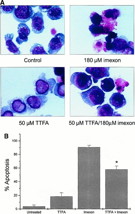 Fig. 6. Protection of RPMI 8226 myeloma cells against imexon-induced toxicity by treatment with TTFA. / The cells were treated with 180 μM imexon or 50 μM TTFA or both and evaluated for morphologic changes by bright-field microscopy after DiffQuick staining (A, × 100 oil immersion). The untreated cells were included as control. Two hundred cells per slide were evaluated for apoptotic changes. The graph represents the fraction of apoptotic cells in the different treatment groups (B). The star indicates a statistically significant difference as compared to the imexon-treated cells (P < .05).