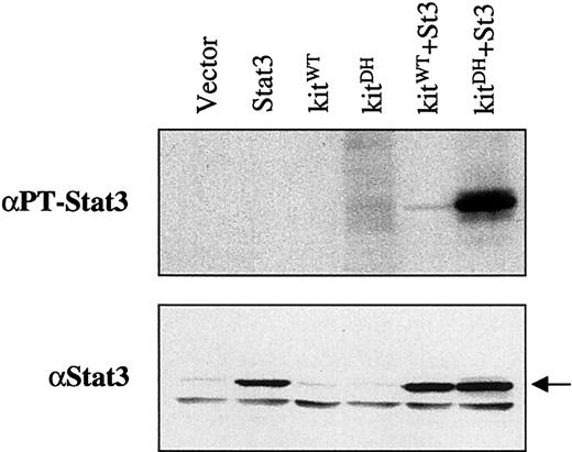 Fig. 3. Constitutive tyrosine phosphorylation of STAT3 in 239 cells cotransfected with D816H mutant c-kit and STAT3. / Each plasmid alone (1.5 μg) or in combinations as indicated was transfected into 293 cells mediated by DOSPER reagents. Forty-eight hours later, cellular lysates were obtained from the cells and analyzed by Western blotting. The blot in the upper panel was probed with the antibody against tyrosine-phosphorylated STAT3. The blot from upper panel was stripped and reprobed with the antibody against the internal domain of STAT3, as shown in the lower panel.