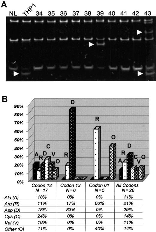 Fig. 1. RAS mutations in elderly AML. / (A) SSCP of PCR products fromNRAS exon 1. Banding patterns from the following samples are demonstrated: normal bone marrow (NL, left lane), THP1 (a positive control with known mutation in exon 1 of RAS), and elderly AML samples 34 to 43. Arrows point to shifted bands in THP1, 39, and 43. Direct nucleotide sequencing confirmed mutations in NRASexon 1 for THP1, 39, and 43. (B) Chart revealing the frequency of specific amino acid substitutions (vertical axis) in NRASand KRAS as separated by individual codons (horizontal axis). Alanine (A), arginine (R), aspartic acid (D), cysteine (C), valine (V), and all other amino acids (O).