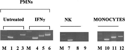 Fig. 1. Analysis of freshly purified PMN purity by FcγRI gene expression. / PMNs were isolated from a buffy coat and incubated overnight in the presence or absence of IFNγ as indicated. NK and monocytes were purified from freshly isolated PBMCs by magnetic cell sorting. With the use of specific primers, we analyzed FcγRI, FcγRII, and β-actin mRNA expression by RT-PCR as described in “Materials and methods.” The present data are given in the following order: Markers (M), β-actin (lanes 1, 4, 7, and 10), FcγRI (lanes 2, 5, 8, and 11), and FcγRII (lanes 3, 6, 9, and 12).