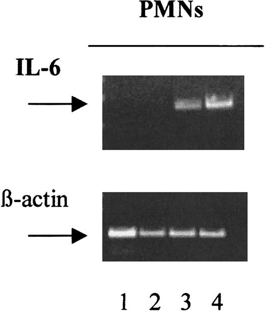 Fig. 2. CD44 ligation with mAbs induces IL-6 gene expression in peripheral blood PMNs. / PMNs were isolated from a buffy coat from a normal donor and incubated for 18 hours in complete medium in the absence or presence of different anti-FcγRs mAbs. RT-PCR, using specific primers, assessed IL-6 and β-actin mRNA expression, as described in “Materials and methods.” The present data are expressed in the following order: unstimulated PMNs (lane 1), anti FcγRI, 32.2 (lane 2), anti FcγRII, IV-3 (lanes 3), and NIH44.1 F(ab)2 (lane 4). This figure shows a representative experiment of 10 performed with similar results.