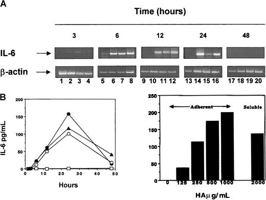 Fig. 4. Kinetics of IL-6 gene expression and protein production after CD44 ligation on normal peripheral blood PMNs. / Freshly purified PMNs were isolated from a buffy coat from a normal donor and stimulated in complete medium. At the indicated times after stimulation, PMNs were harvested as source of total RNA, and the supernatants were collected for ELISA IL-6 protein assays. (A) This panel shows that, using sense and antisense specific primers, RT-PCR analyzed IL-6 and β-actin gene expression: lanes 1, 5, 9, 13, and 17, unstimulated PMNs; lanes 2, 6, 10, 14, and 18, NIH44.1 F(ab)2; lanes 3, 7, 11, 15, and 19, HA 100 μg/mL; and lanes 4, 8, 12, 16, and 20, LPS 12.5 ng/mL. (B) Left side shows IL-6 production measured in the supernatants collected at the indicated times: unstimulated PMNs (open squares), PMNs stimulated with NIH44.1 F(ab)2 (closed circles), HA 100 μg/mL (open circles), and LPS 12.5 ng/mL (closed triangles). Right side shows the IL-6 production measured in the supernatants of human PMNs stimulated overnight with immobilized or soluble HA at the indicated doses.