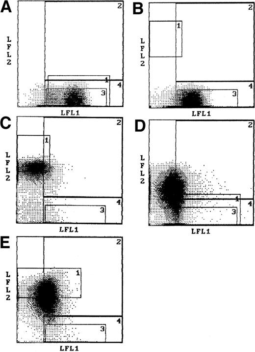 Fig. 4. Dot plots of patients with loss of H. / Red blood cell spheres stained with Ulex (LFL1) from an O patient with MDS (A) and an O patient with AML (B) both with a normal population of cells and a population of cells having diminished H fluorescence. The red blood cell spheres from an A1O patient with AML (C) and an A1O patient with CMML (D) stained with Helix (LFL2) and Ulex (LFL1). The loss of H is more extensive in the patient with CMML and is affecting the levels of the A antigen as well. (E) Red blood cell spheres from a BO patient with MPD stained with anti-B (LFL2) and Ulex (LFL1).
