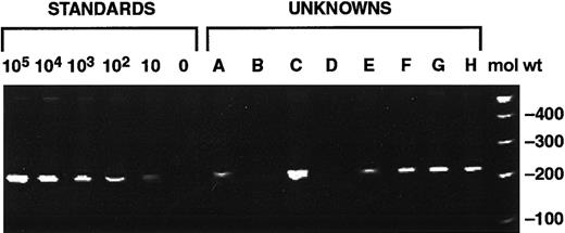 Fig. 1. QA-PCR calibration curve of known copy numbers of cloned CMV polymerase gene. / Lanes 1 to 6 show 240-bp amplification product of pCMPol2B at 105, 104, 103, 102, 10, 0 GE/500 ng human CMV− genomic DNA. Lanes 7 to 14 are test samples (A-H) from this study. Molecular weight markers are in lane 15 (mol wt).