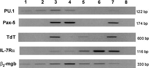 Fig. 7. Gene expression in cord blood progenitor subpopulations. / RNA was extracted and reverse-transcribed from FACS-isolated populations from pooled cord blood (lanes 1-4) or thymus (lanes 5 and 6), and cDNA from equal cell numbers of each population (600 cells for PU.1, Pax-5, and TdT; 1200 cells for IL-7Rα; 300 cells for β2-mgb) were subjected to PCR to amplify genes shown. Lane 1: CD34+CD38−CD7−, Lane 2: CD34+CD38−CD7+, Lane 3: B-lymphoid progenitors (CD34+CD19+), Lane 4: B cells (CD34−CD19+), Lane 5: CD3+CD4+CD8+ thymocytes, Lane 6: CD3+CD4+CD8− thymocytes, Lane 7: positive control cell lines (see “Materials and methods”), and Lane 8: negative control (no cDNA). Results are representative of at least 3 independent experiments. β2-mgb indicates β2-microglobulin.