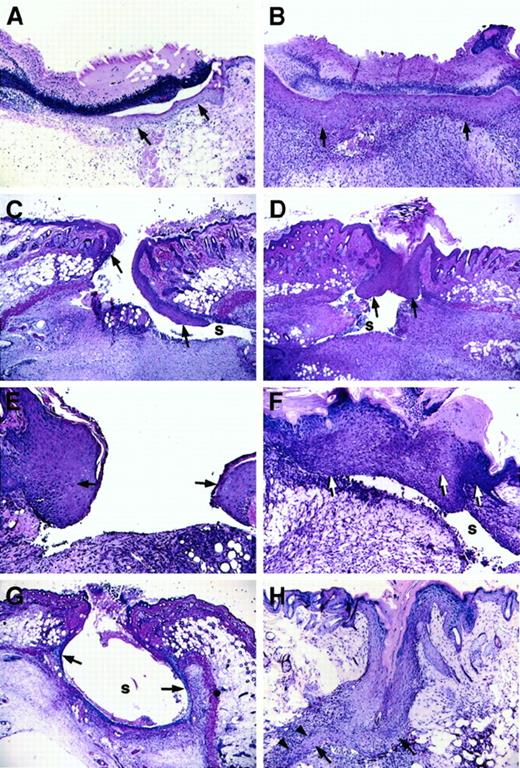 Fig. 1. Microscopic appearance of incision wounds, shown perpendicular to the longitudinal direction of the wound, of control and Fib−/− mice. / (A) Normal epithelial cell migration below the eschar in a control mouse 3 days after wounding. (B) Complete re-epithelialization of a control mouse at 6 days. (C) Altered pattern of epithelial cell ingrowth observed in Fib−/− mice on day 3 with the leading edge of epithelial cells proceeding down the dermal wound edge into a sinus (s) formed at the edge of the wound bed, and away from the center of the wound. (D) Re-epithelialization in a Fib−/−mouse 6 days after injury by unification of epithelium that had previously followed the dermal face into a prominent sinus (s). (E) Epithelial hyperplasia commonly observed at the leading edge of 5-day-old wounds of Fib−/− mice. (F) Fusion of an abnormally hyperplastic endothelium in a Fib−/− mouse (day 7) leaving a persistent sinus below the epithelium. (G) Partial re-epithelialization in a Fib−/− mouse (day 4) by “paving” the entire inner surface of a wound sinus. (H) Re-epithelialization in a Fib−/− mouse (day 7) with the formation of a spur (arrowheads). Epithelium is indicated with arrows; gaps, or sinuses, in the wound field are indicated with an “s.” Panels A-D, G, and H: original magnification 40×. Panels E and F, original magnification 100×. Hematoxylin and eosin stain.