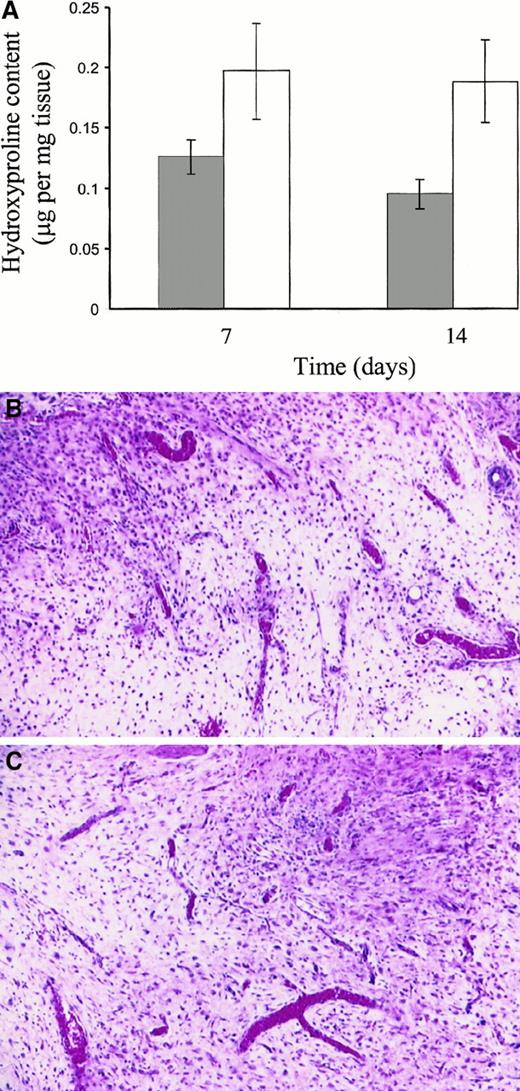Fig. 3. Hydroxyproline content and granulation tissue appearance of incisional wound tissue after 7 and 14 days. / (A) Hydroxyproline content of control mice (░) and Fib−/− mice (■). Histologic analyses indicating similar cell density and qualitative appearance of granulation tissue in wound tissue collected at day 14 from control (B) and Fib−/−mice (C). Hematoxylin and eosin stain; original magnification, 200×.