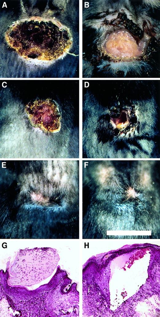 Fig. 5. Healing pattern of excisional wounds of control and Fib−/− mice. / (A-F) Representational views of the gross appearance of excision wounds after 4 days (A and B), 8 days (C and D), and 21 days (E and F) in control (A, C, and E) and Fib−/− (B, D, and F) mice. Note the open wounds in the Fib−/− mice in B and D. Microscopic appearance of day 8 excisional wounds of control mice (G) and Fib−/− mice (H). Note the presence of a prominent sinus or fissure that is bordered by exuberant granulation tissue and covered by epithelium typical of that encountered in Fib−/− mice (H).