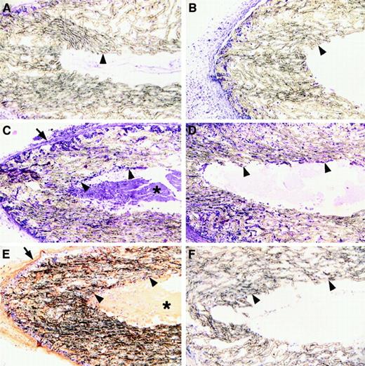 Fig. 7. Microscopic analysis of high porosity chambers implanted subcutanteously into control and Fib−/− mice. / Panels A, C, and E show microscopic sections prepared from control mice; panels B, D, and F show sections prepared from Fib−/− mice. Panels A and B show implants left in place for 7 days and panels C-F show implants left in place for 21 days. Panels A-D were stained with hematoxylin and eosin; panels E and F were stained for fibrin(ogen) by immunohistochemistry (brown reaction product). The inside and outside boundaries of the porous tubing are indicated with arrowheads and arrows, respectively. Note that by day 21 the walls of the porous tubing are heavily infiltrated with cells regardless of the presence or absence of fibrin(ogen). Also note that dense fibrillar material (asterisk) containing fibrin(ogen) is present within the lumen of implants of control mice, and this is deeply infiltrated with cells (C and E). In contrast, only amorphous material is present within these spaces in Fib−/− mice and cells are only found proximal to the luminal surface of the implants.